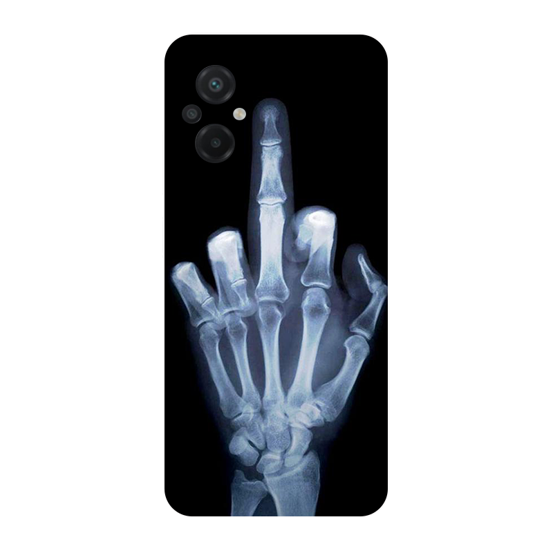 for Poco M5 2022 4G Case Footb - огляд і ціна Phone Cases Liverpool